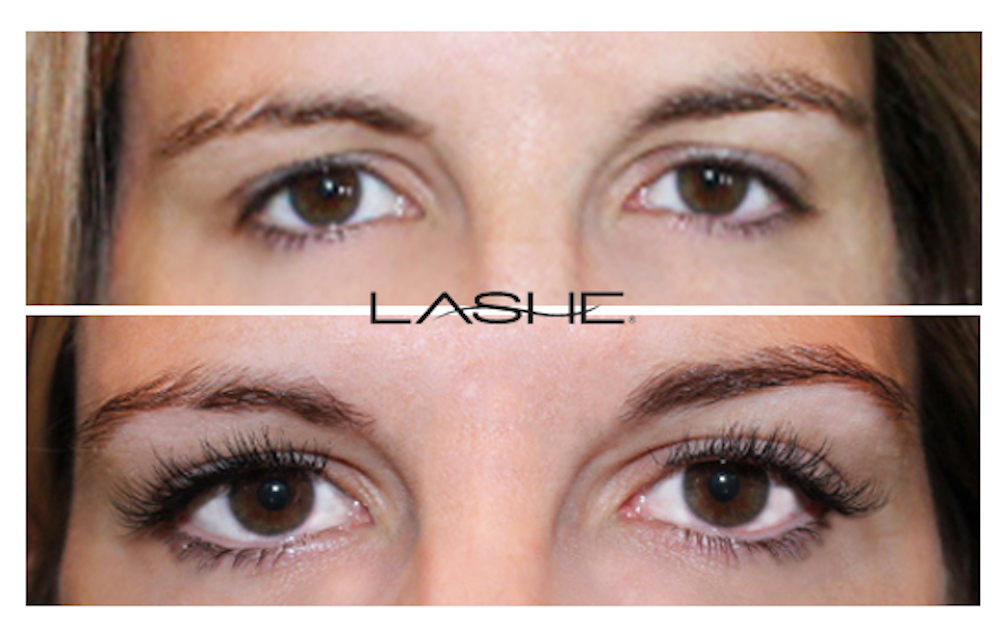Eyelash extensions before and after9
